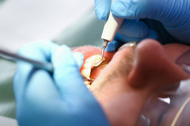 Best Emergency Dental Surgery in Jonesborough, TN